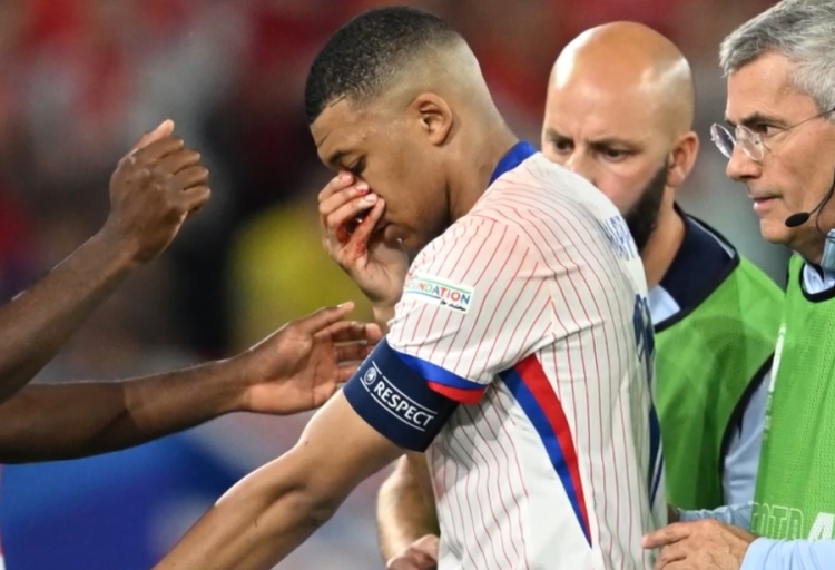 Jogador da França, MBAPPÉ em atendimento após quebrar o nariz.